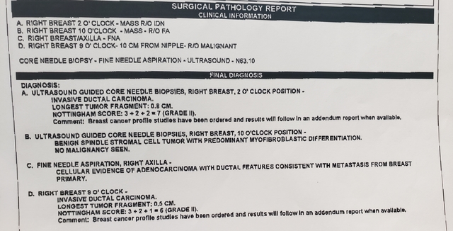 Breast Cancer Topic Can Someone Help Me Understand My Results